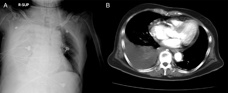 Figure 1: