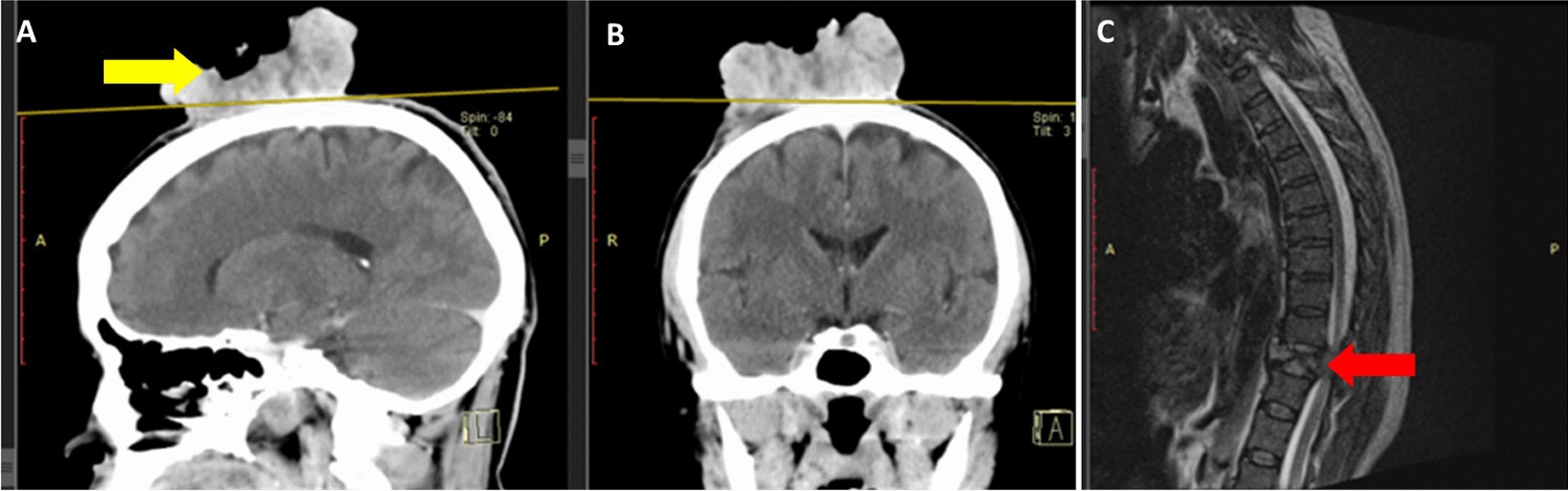 Fig. 2