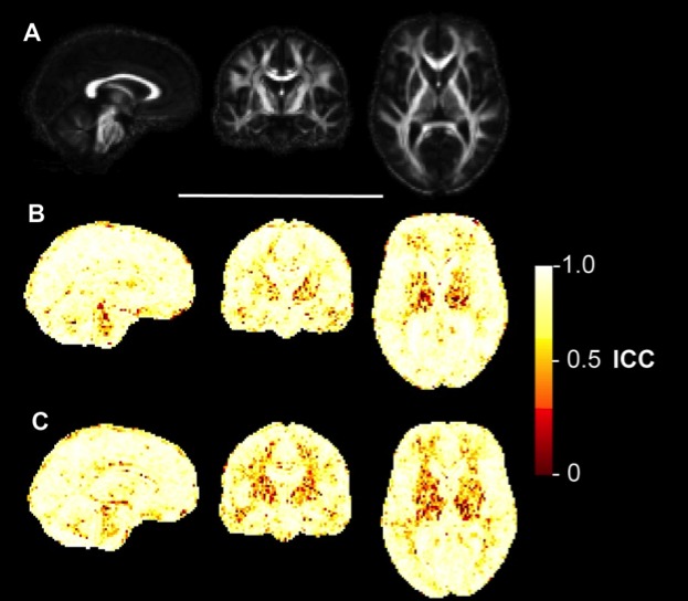 Figure 6 MD maps