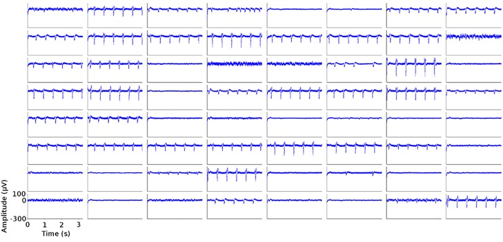 Fig 3