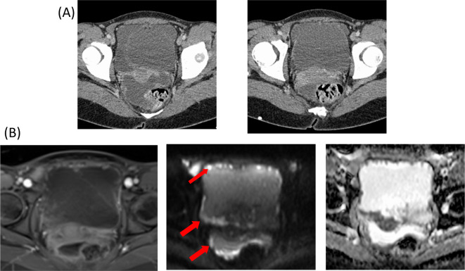 Figure 10.