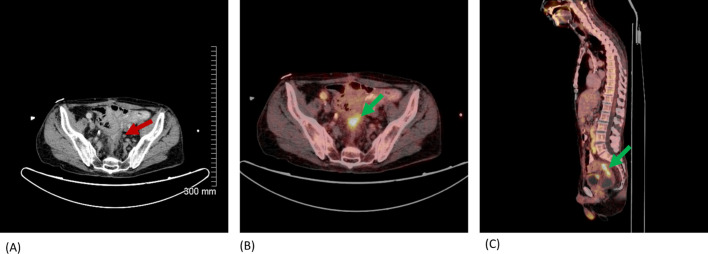 Figure 9.