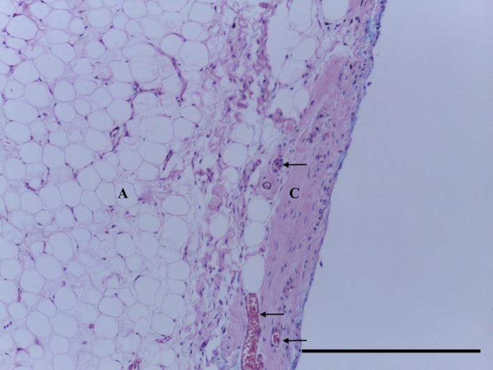 Figure 18