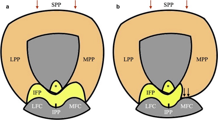 Figure 26