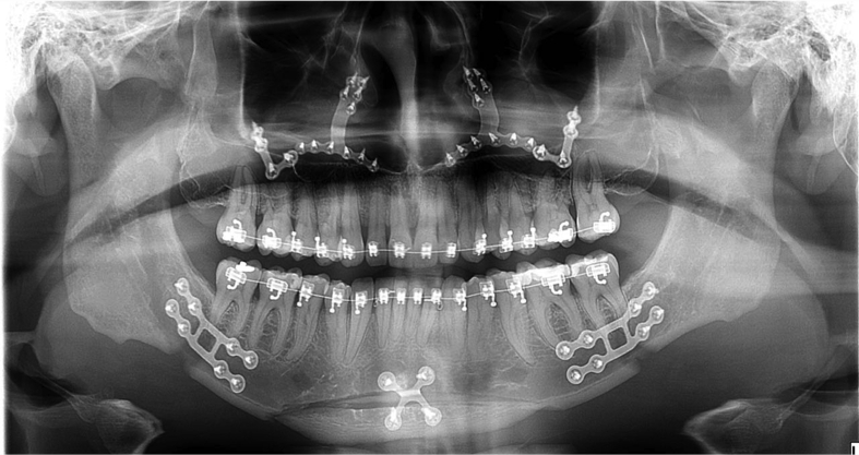 Figure 2