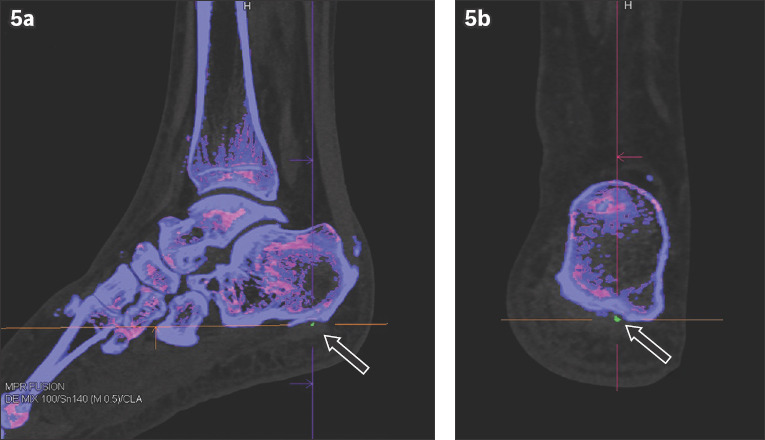 Fig. 5