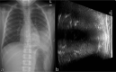 Figure 11.