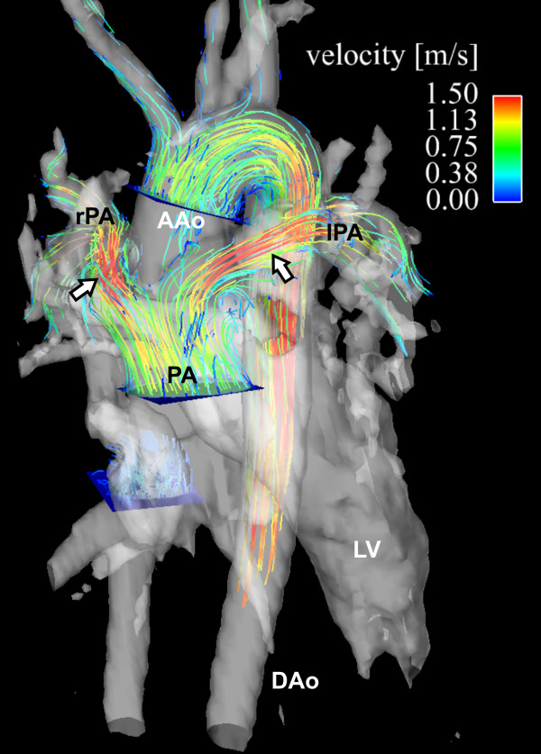 Figure 14