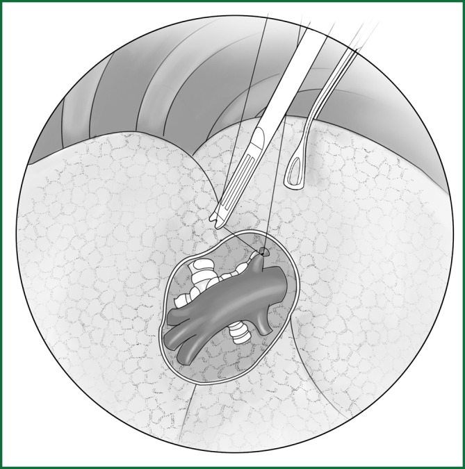 Figure 26