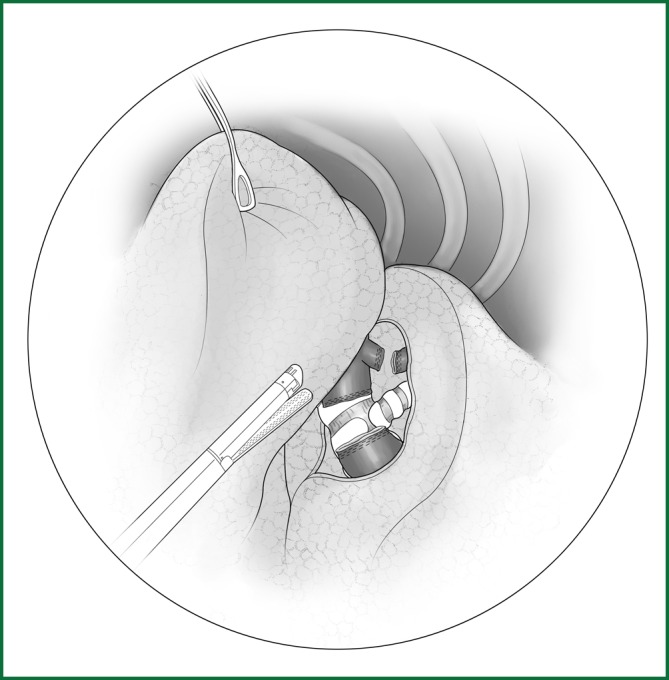 Figure 46