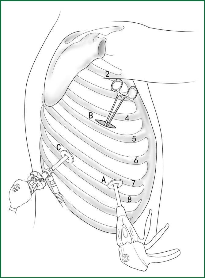 Figure 39