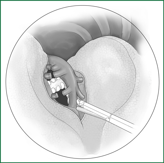 Figure 43