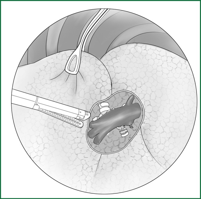 Figure 34