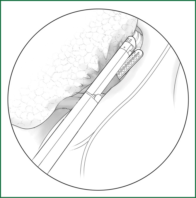 Figure 24