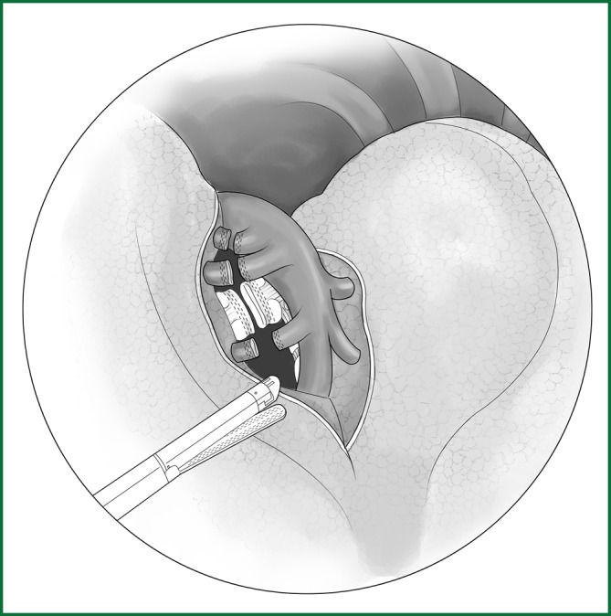 Figure 44