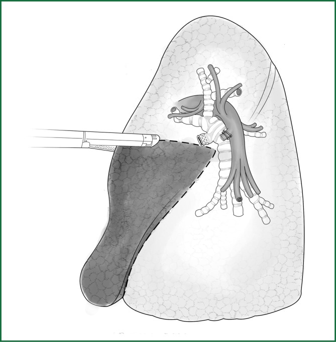 Figure 53