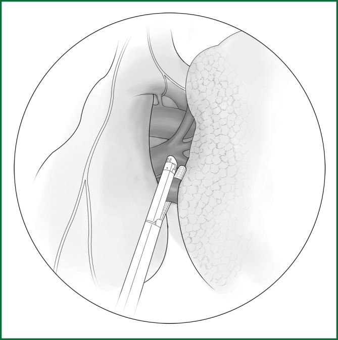 Figure 45