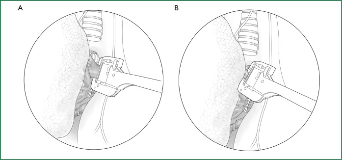 Figure 58