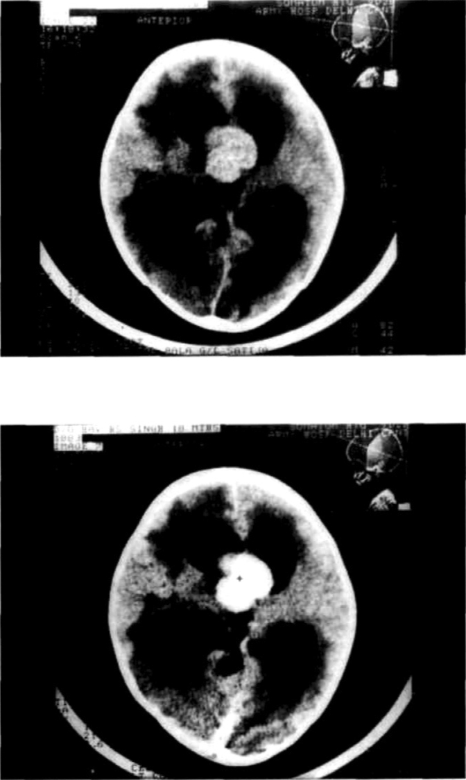 Fig. 6a & b