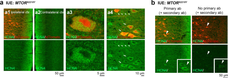 Figure 3—figure supplement 2.