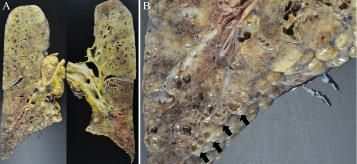 Fig. 3