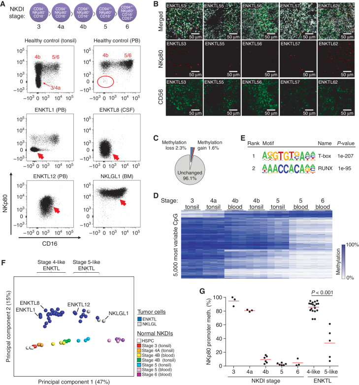 Figure 1. Relationship of ENKTL to normal NK-cell development using immunophenotyping and genome-wide DNA methylation patterns. A, Top indicates the cell surface markers delineating NKDI stages. Below are flow cytometry analyses showing NKDI stages in healthy adult tonsil and PB after gating on lineage-negative, CD56+ cells. Stage 3/4a NKDIs are not observed in blood from healthy donors (red oval). Patients with ENKTL or NKLGL derived from PB, BM, or CSF are displayed using the same gaiting strategy. ENKTL1 and 8 displayed atypical CD16−NKp80− NK-cell populations reminiscent of stage 4a NK-cell precursors (thick red arrows). ENKTL12 displays an atypical NKp80+CD16Dim population more reminiscent of stage 5 NKDIs. NKLGL is stage 5 like. All plots were gated on lineage−CD56+ cells. B, Immunofluorescent confocal microscopy images of ENKTL tumors stained for NKp80 (red) and CD56 (green) then merged with DAPI (white, top). Despite broad positivity for CD56, only ENKTL62 showed consistent NKp80 staining. C, Total number of CpGs displaying altered methylation between stage 3 and stage 6 of NK-cell development. D, Heat map showing the 5,000 most variable CpGs across NKDI samples. E, Most enriched DNA sequence motifs proximal (±100 bp) to hypomethylated CpGs during NK-cell development (stage 3 to 6 NKDIs). F, Principal component analysis of NKDIs and ENKTLs using the 5,000 most-variable CpGs among NKDIs. ENKTL samples in A are indicated. G, NKp80 (KLRF1) promoter methylation levels assessed by targeted MassARRAY analysis in NKDI stages and ENKTL separated into stage 4- and 5-like subgroups. CpGs in the vicinity of the NKp80 promoter were averaged for individual NKDI and ENKTL samples.