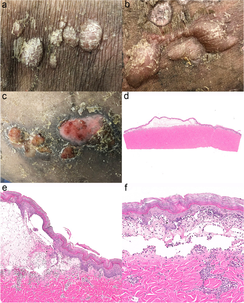 Fig. 13