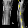 Figure 1-2: