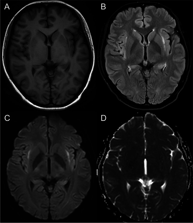 Fig. 1