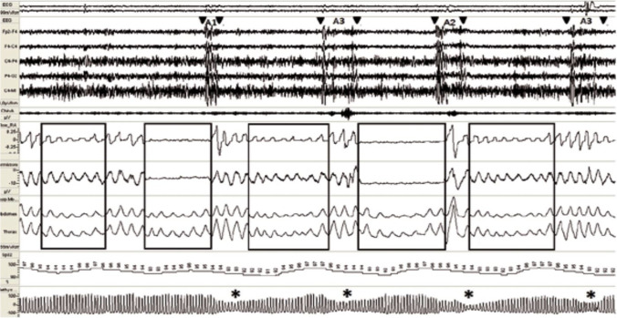 Fig. 5
