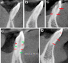 Fig.1