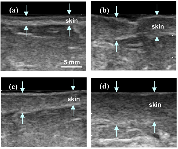 FIG. 5