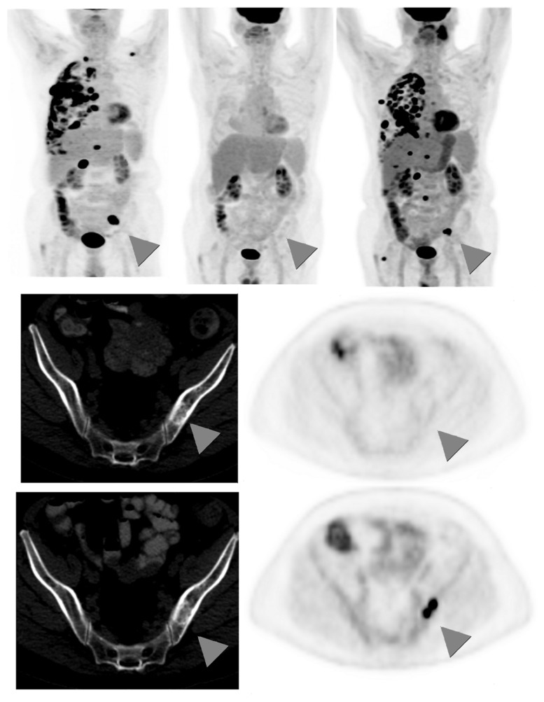 FIGURE 3