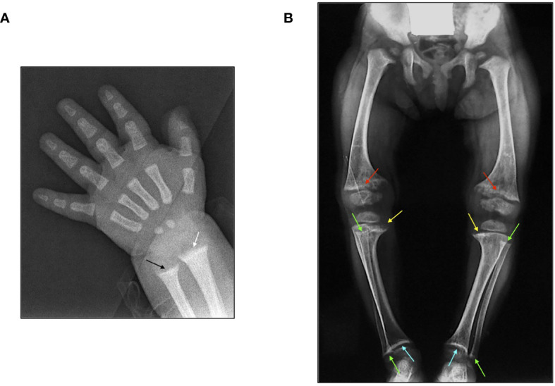 Figure 3