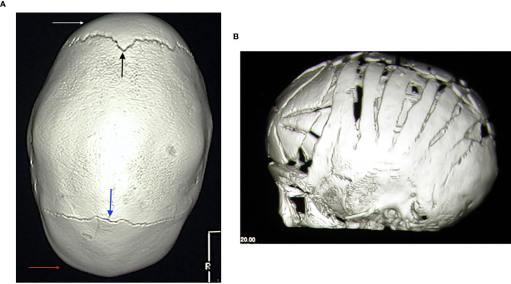 Figure 4