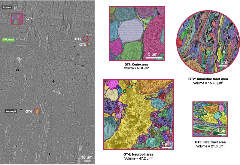 Figure 1—figure supplement 2.