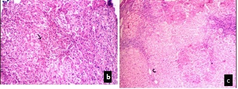 [Table/Fig-4b,c]: