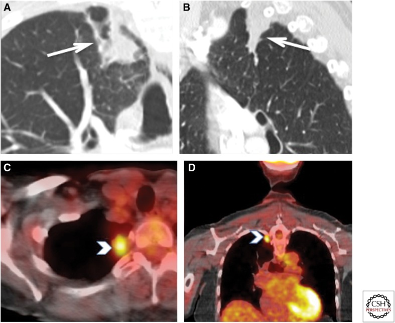 Figure 17.