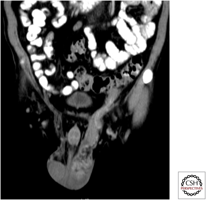 Figure 14.