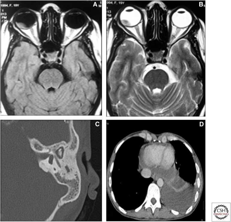 Figure 16.