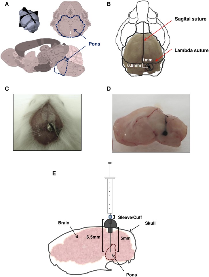 Fig 1