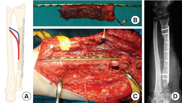 Fig. 6.