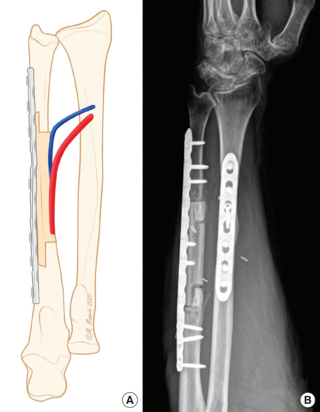 Fig. 5.