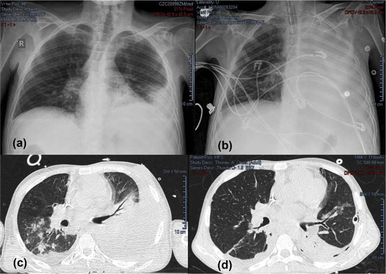 Fig. 1