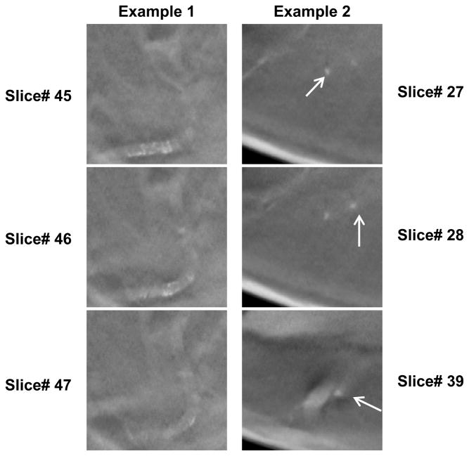 Fig. 12