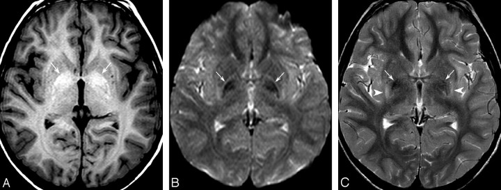 Fig 1.