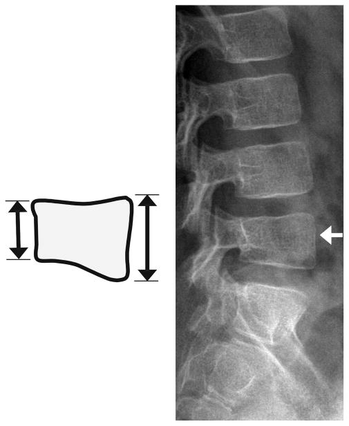 Fig. 13