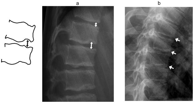 Fig. 11