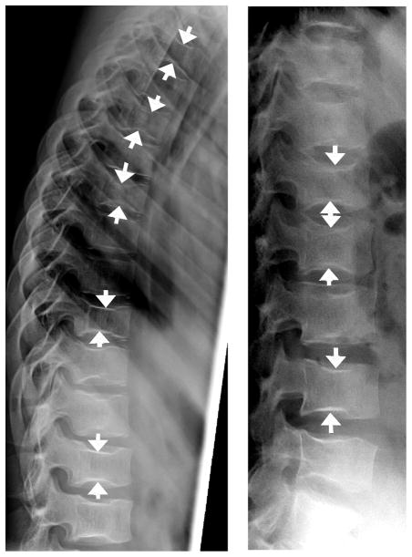 Fig. 12