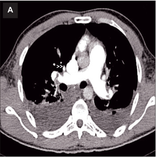 Fig 3A